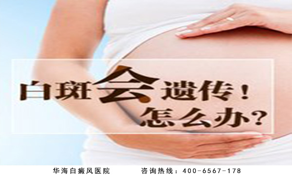 白癜風(fēng)遺傳