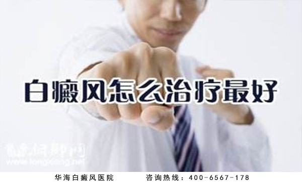 白癜風(fēng)治療最好方法